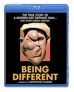 Being Different [Blu-ray] Cover